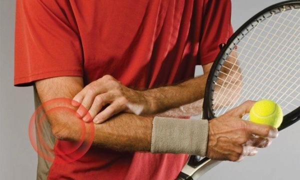 Hội chứng tennis elbow - cách điều trị và phòng ngừa