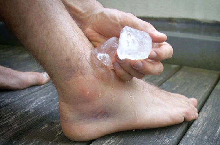 Chườm đá lạnh để giảm bớt đau gót chân