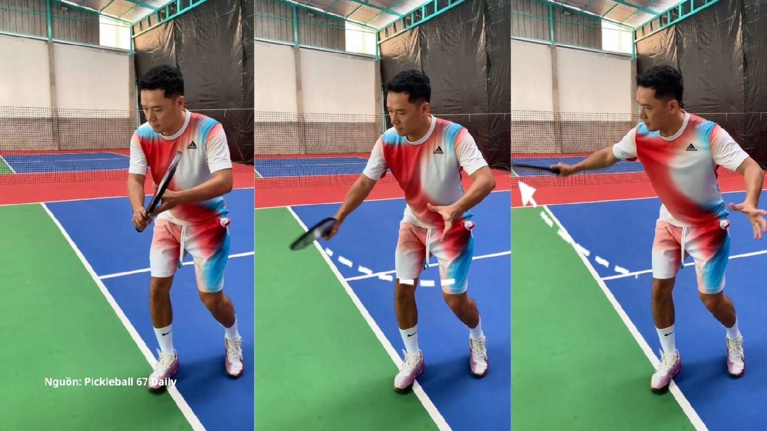 kỹ thuật Backhand Pickleball 1 tay