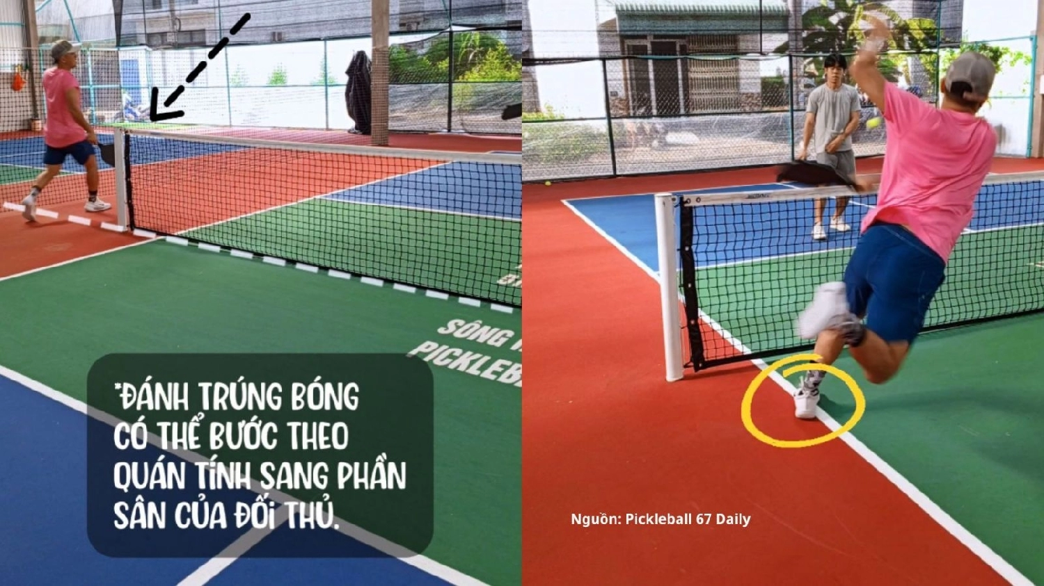 Kỹ thuật đập bóng Pickleball kiểu Erne - Erne Shot