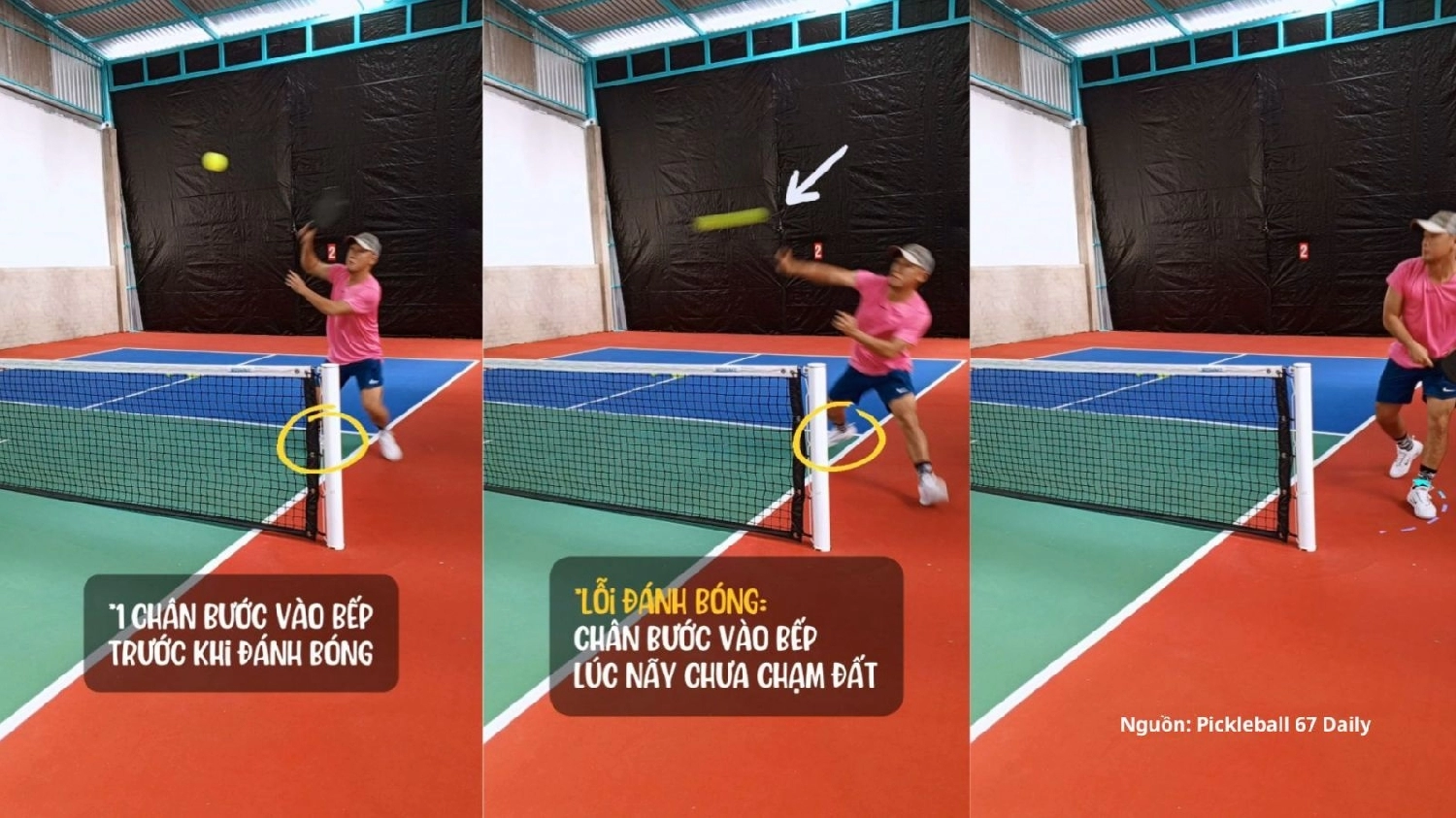 Kỹ thuật đập bóng Pickleball kiểu Erne - Erne Shot