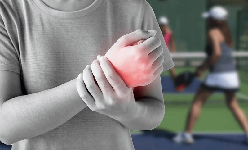 Biểu hiện đau cổ tay khi chơi Pickleball